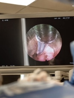 Endoscopic Spine Surgery