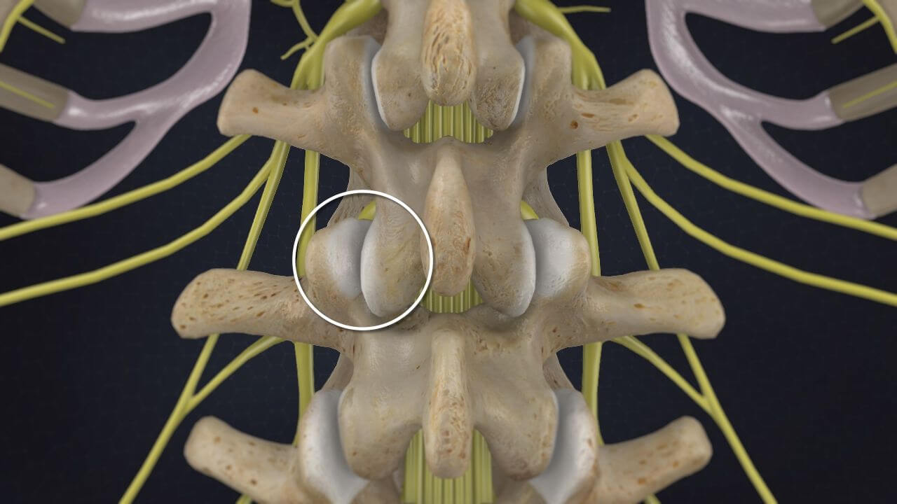 A facet joint highlighted on a model of the human spine.