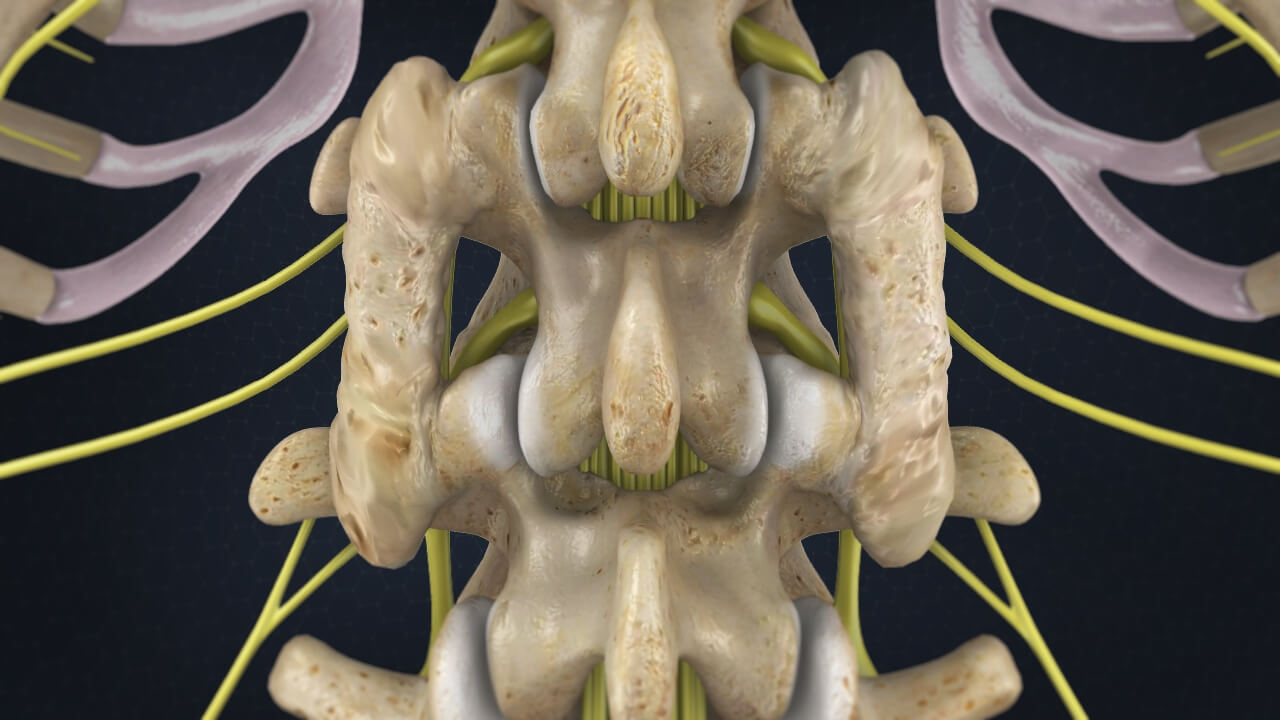 A Computer-Generated Image Of The Back Of A Person's Spine