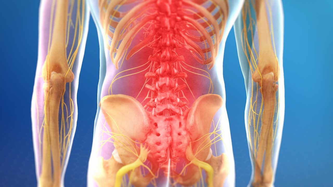 The cause of your chronic lower back pain - Vertebrogenic pain