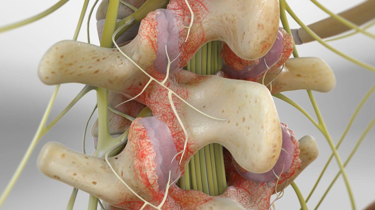 A Computer Generated Image Of A Spine With Nerves And Muscles