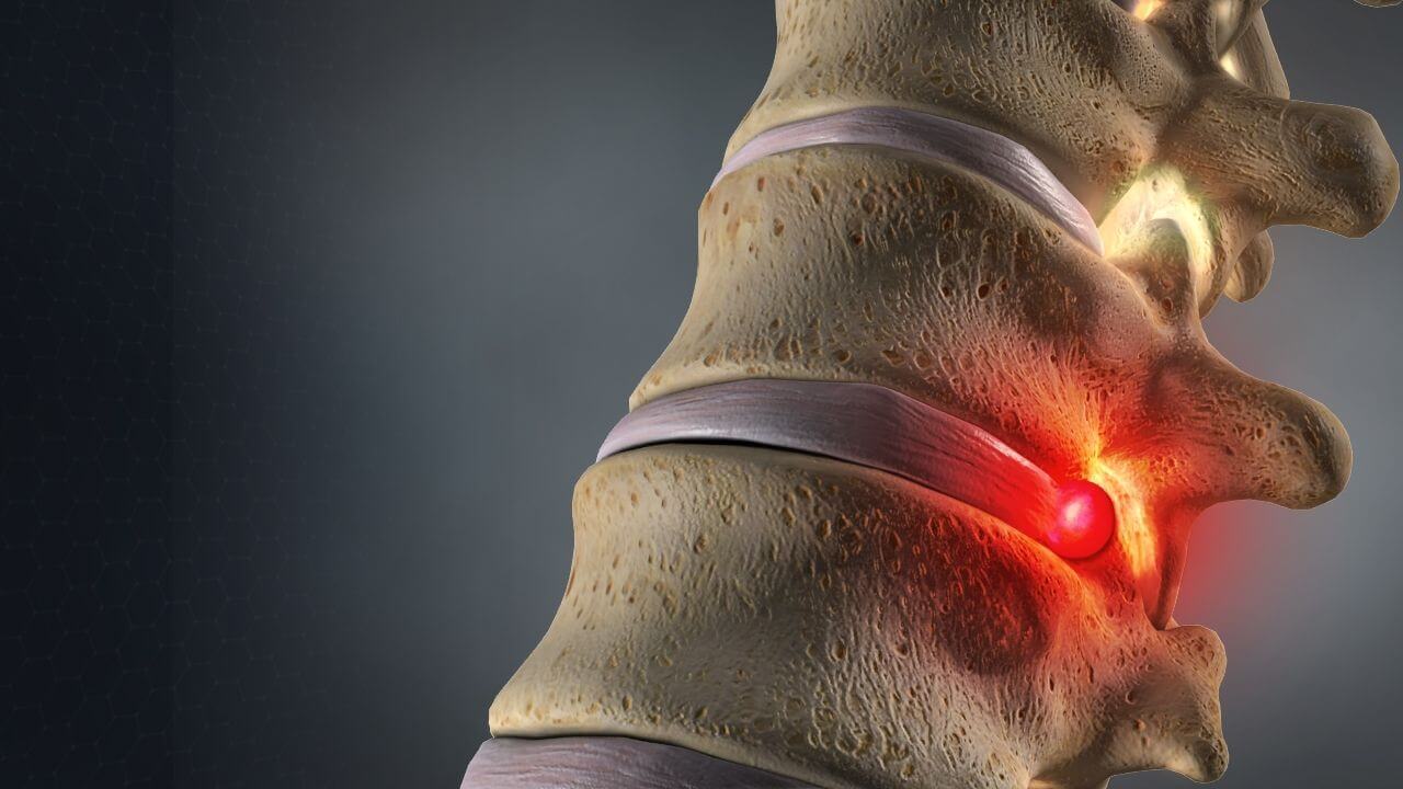 A Close Up Of A Spine With A Red Spot On It