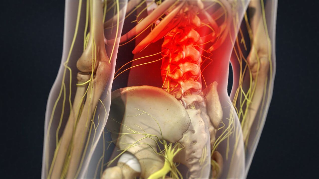 Skeletal Model of Back Showing Pain Area