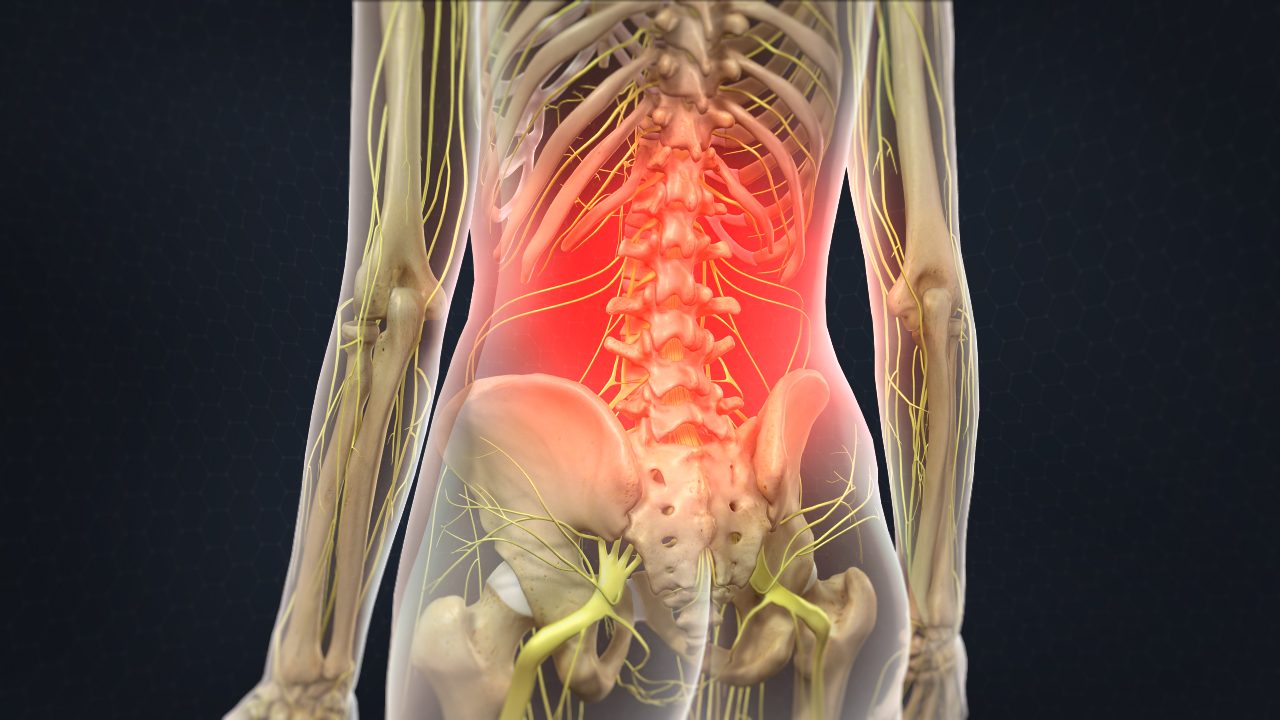 The cause of your chronic lower back pain - Vertebrogenic pain
