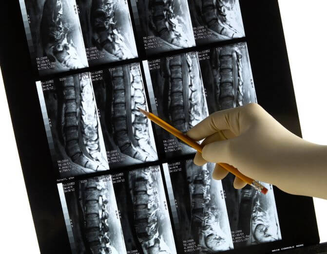 Doctor pointing to an image in a series of x-rays.