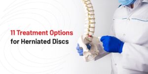 A Doctor Is Holding A Model Of A Spine And The Words 11 Treatment Options For Herniated Discs