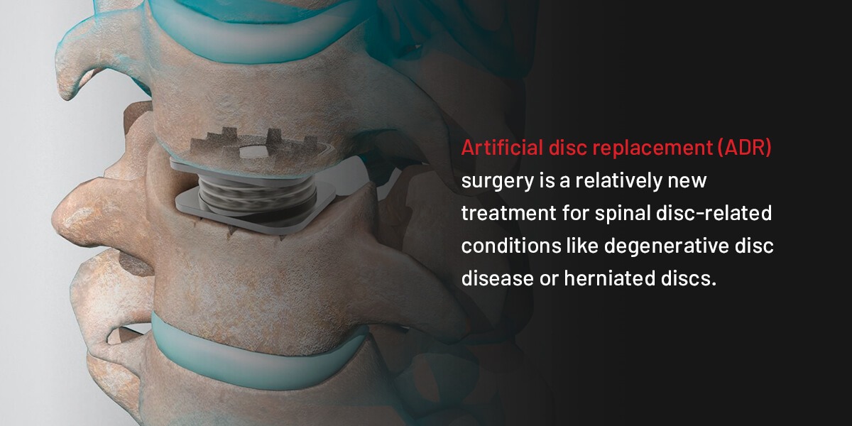 11 Various Treatment Options to Help with a Herniated Disk