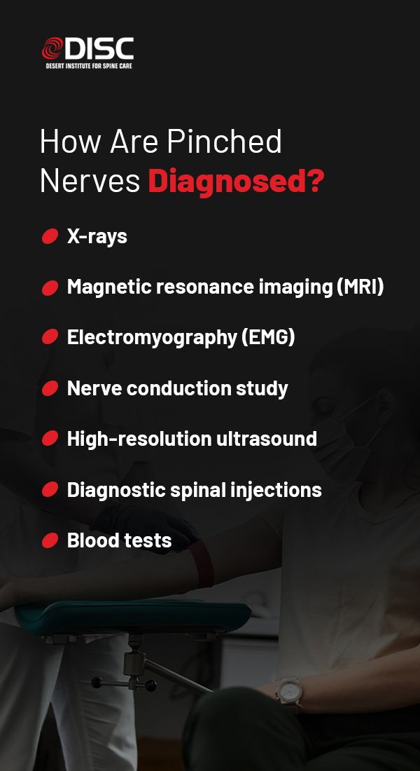 https://www.sciatica.com/wp-content/uploads/2023/05/04-How-Are-Pinched-Nerves-Diagnosed-RE-1-dd45a24f.jpeg