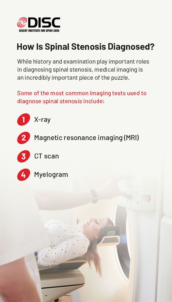 Spinal Stenosis: Symptoms, Diagnosis and Treatment