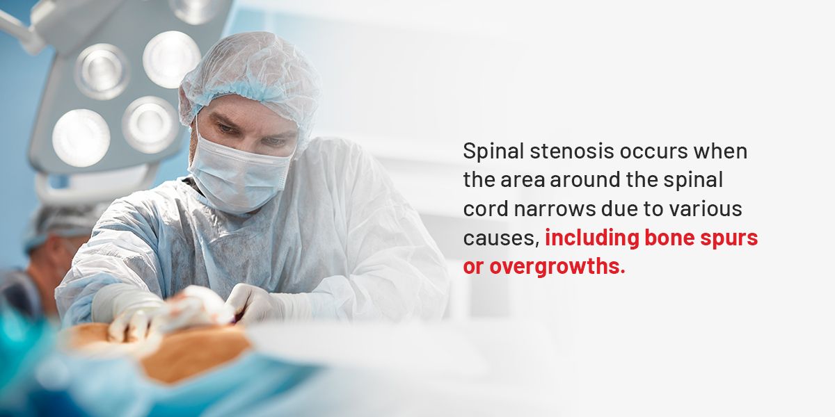 Spinal Stenosis Treatment Options - Advanced Wellness Solutions