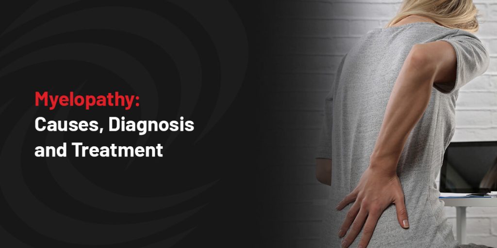 Myelopathy: Causes, Diagnosis and Treatment