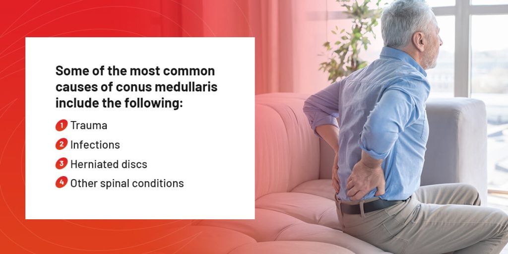 What Causes Conus Medullaris?