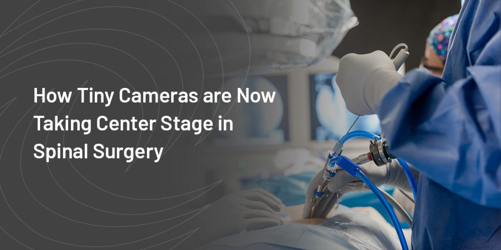 How Tiny Cameras are Now Taking Center Stage in Spinal Surgery