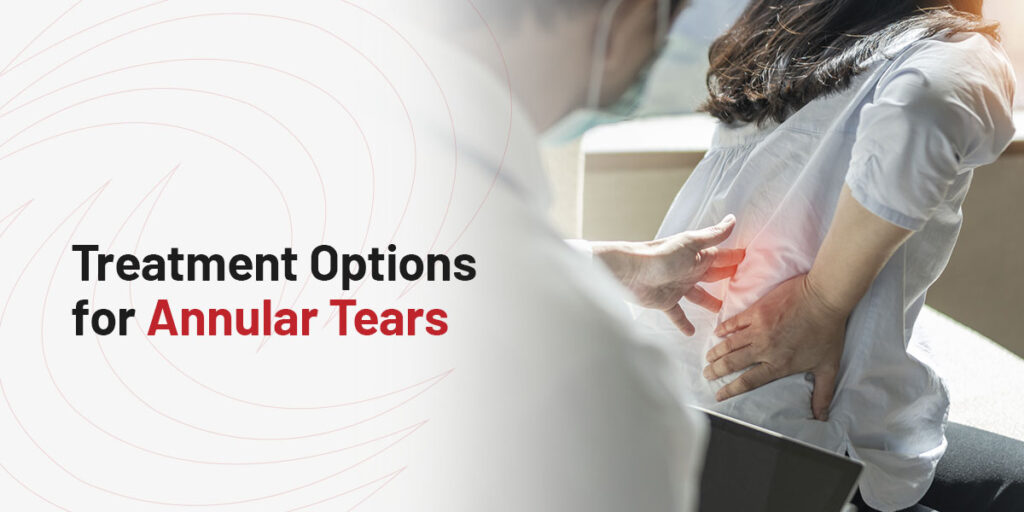 Treatment Options for Annular Tears