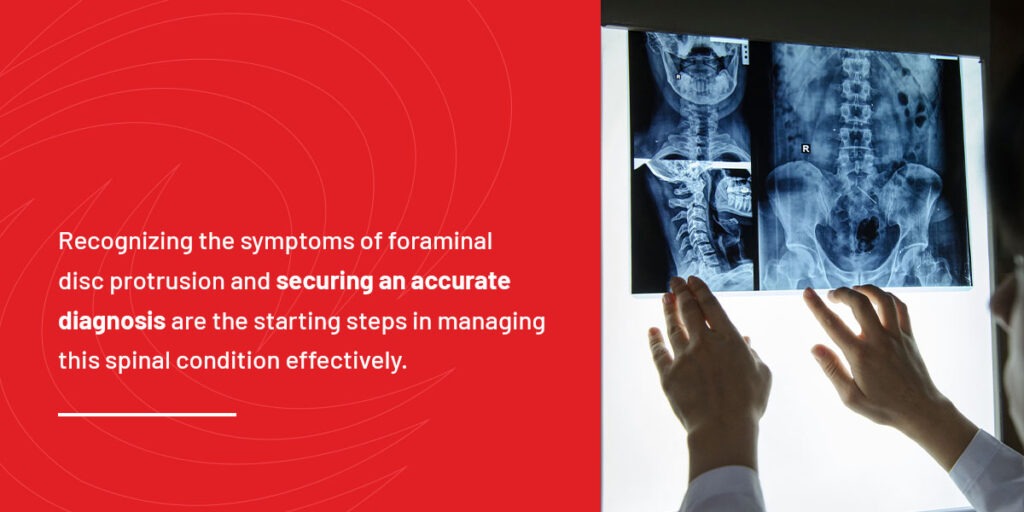 Symptoms and Diagnosis