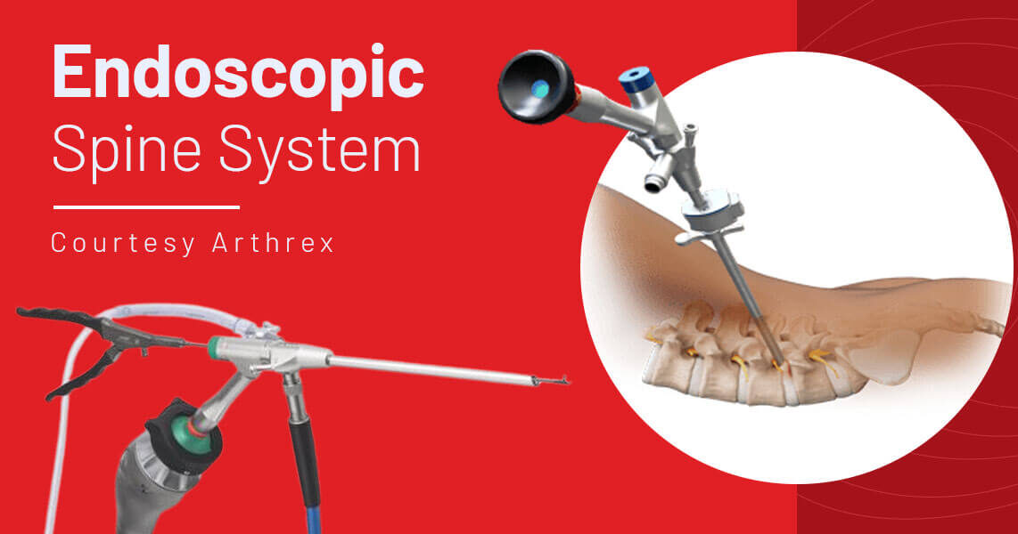 Endoscopic spine system