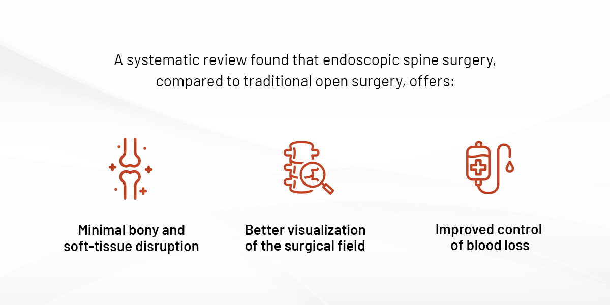 What Is Endoscopic Decompression?