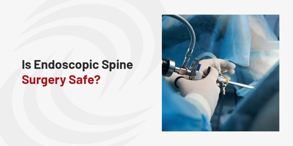 Endoscopic Discectomy (Selective Endoscopic Discectomy) | DISC