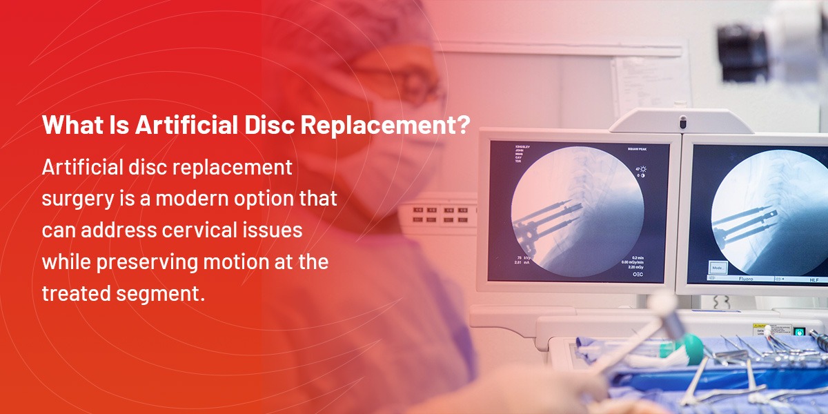 Endoscopic Surgery vs. ADR - Desert Institute for Spine Care